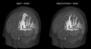 Meditation alleviating pain How to Drive Results Wellbeing with PeopleCentric Leadership